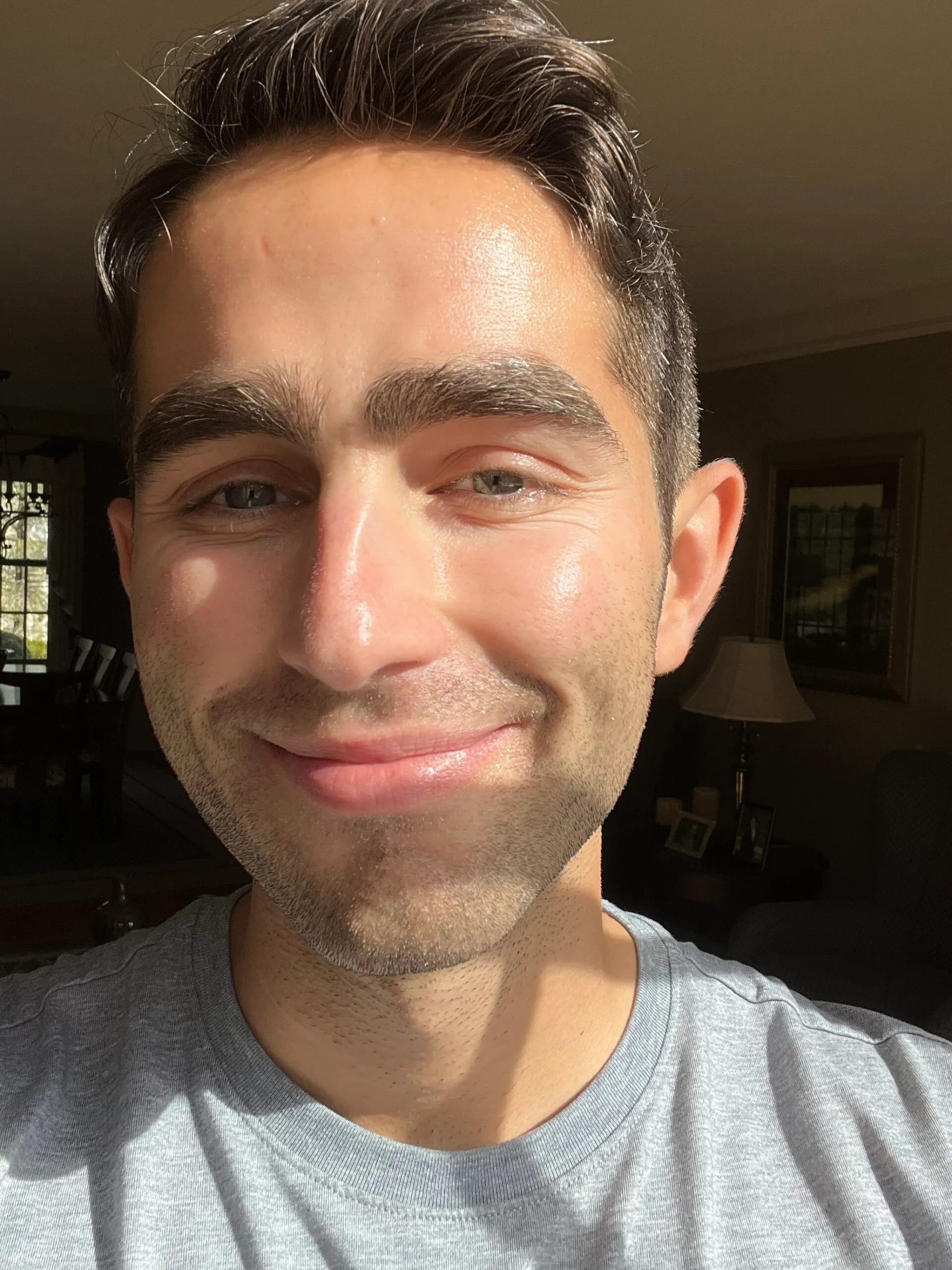 Photo showing skin before using the skincare in this article